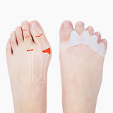 Pack of 2 Toe Separator - Gel Non Slip Bunion Toe Spacer Overlapping Hammer Toes