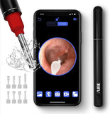 AIRE Ear Wax Removal Kit with 1080P FHD WiFi Ear Camera and 6 LED Lights